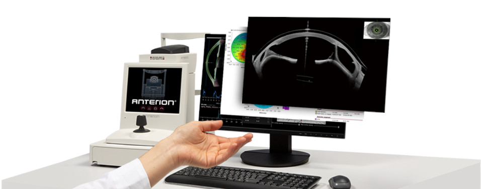 Featured image of Anterion: A Revolution in Refractive Surgery